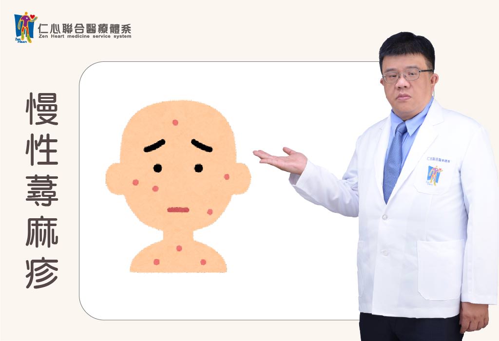 慢性荨麻疹