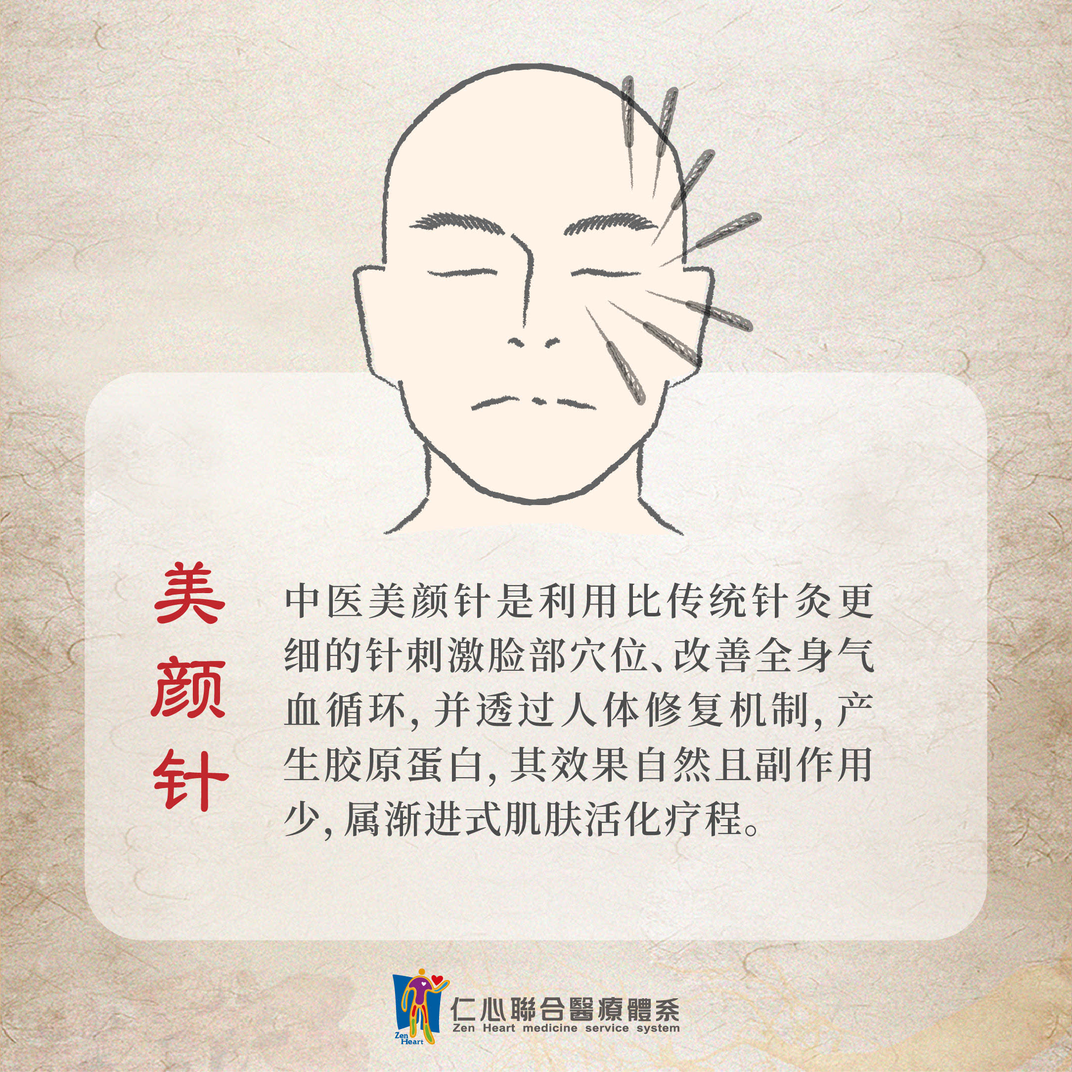 美颜针