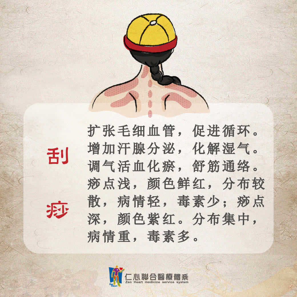 刮痧