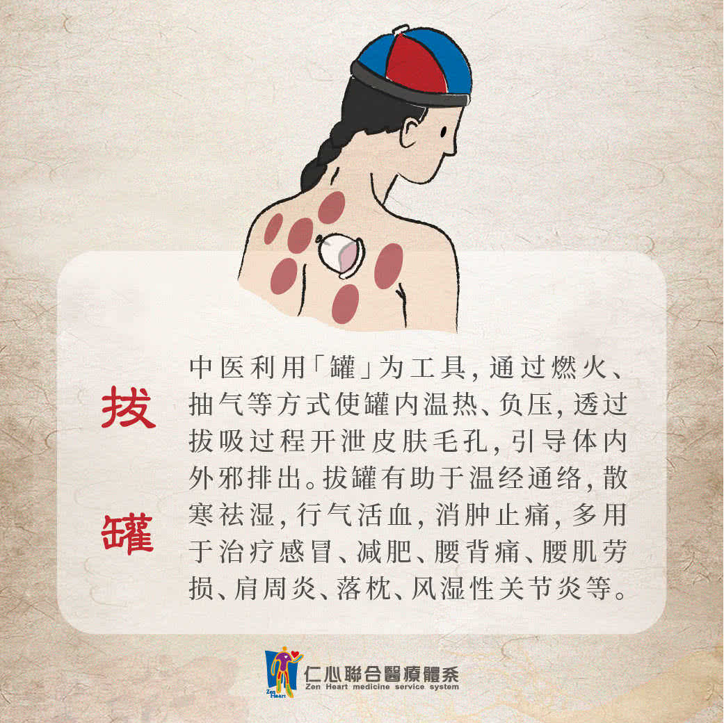 拔罐